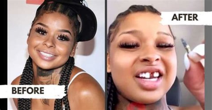 Chrisean Rock Before Fame Photos: What Did She Do To Her Face?